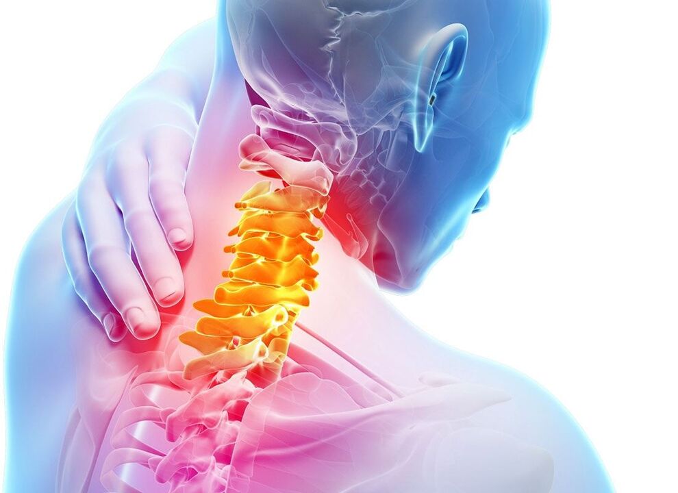 Localización de la osteocondrosis. 